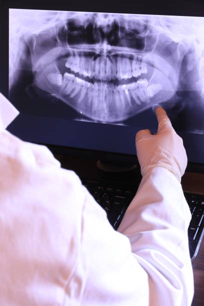 Best Knocked-Out Tooth Emergency  in Lamar, TX