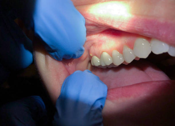 Best Urgent Tooth Repair  in Lamar, TX